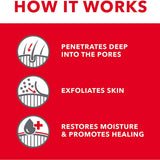 OxyMed Medicated Oatmeal Treatment - 355ml